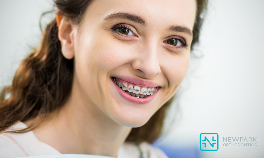 Cost of Orthodontic Braces Without Insurance