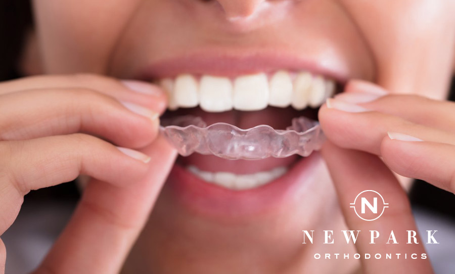 Surviving Your First Week with Invisalign