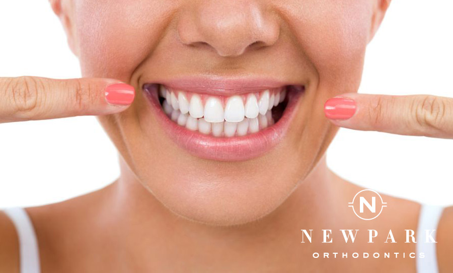 Teeth White Cleaning - Newpark Orthodontics