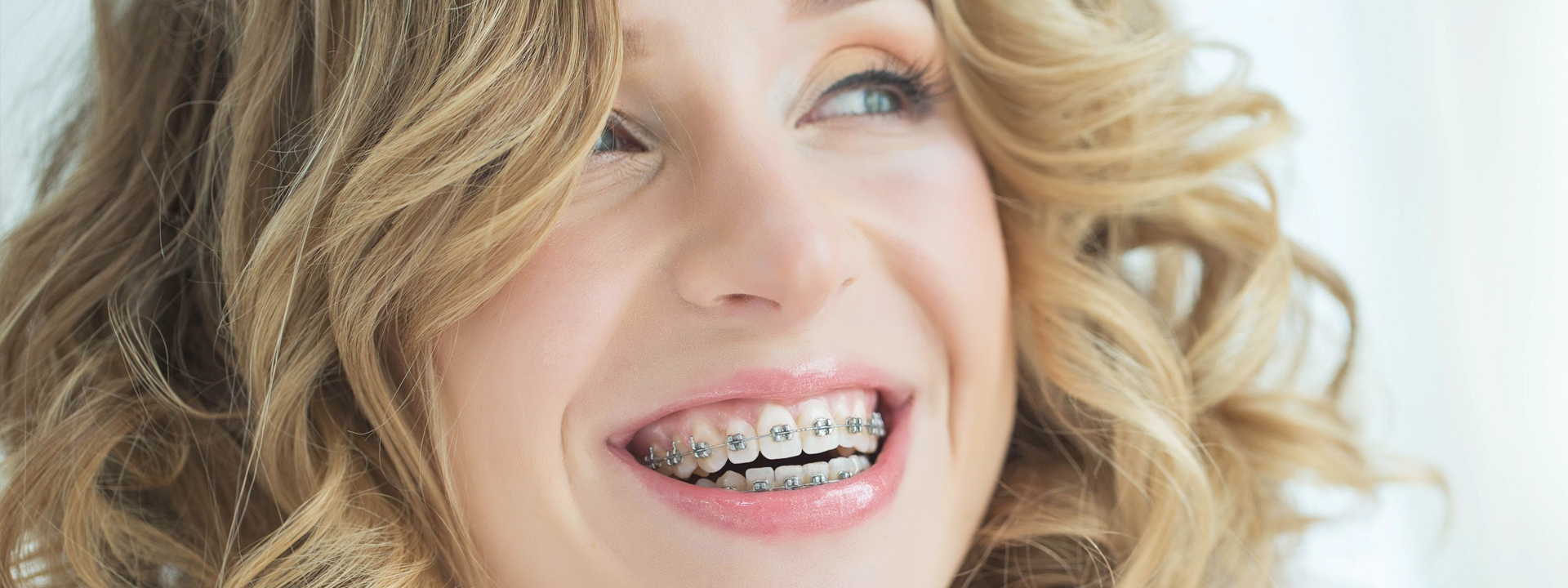 Metal Braces in Alpharetta