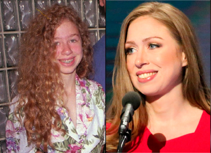 Chelsea Clinton - Braces Treatment