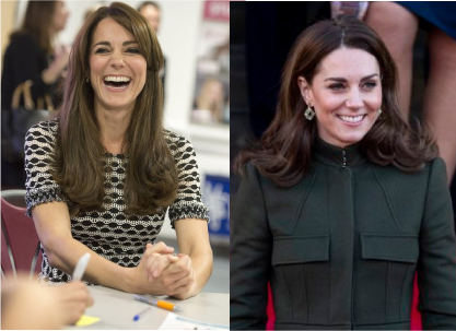 kate middleton lingual braces