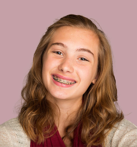 Traditional Metal Braces