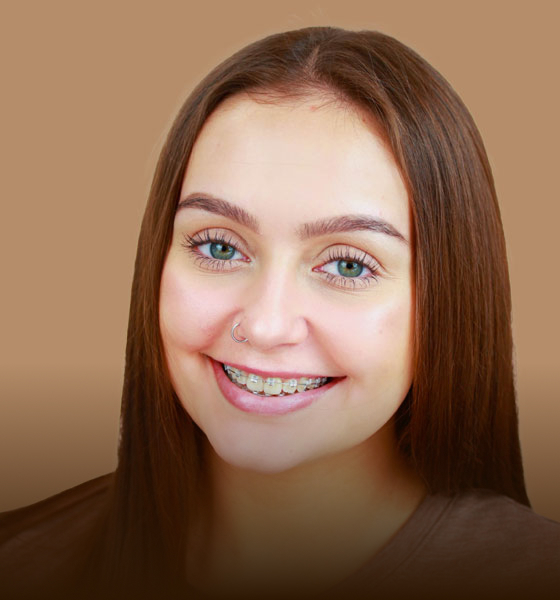 Ceramic Braces