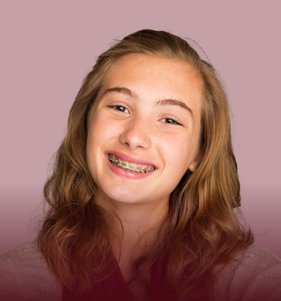 Traditional Metal Braces